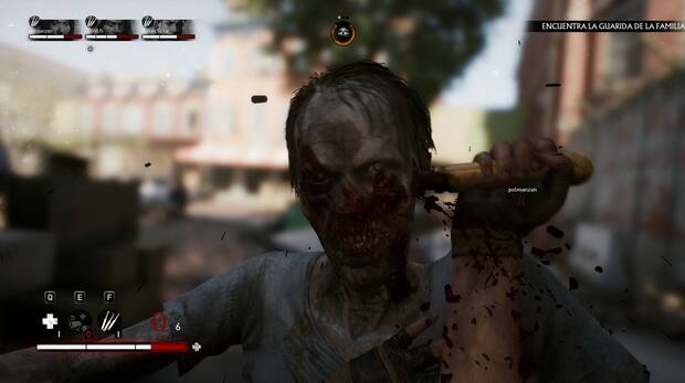 Los ataques cuerpo a cuerpo de los zombis son muy peligrosos.