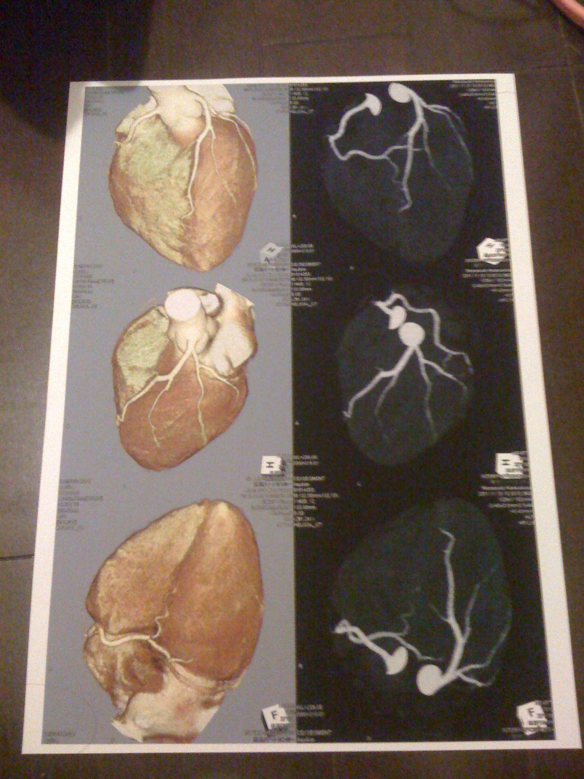 Imagen 20111115165810_2